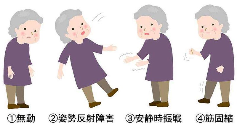 パーキンソン病にヨガ療法