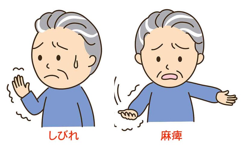 しびれと麻痺